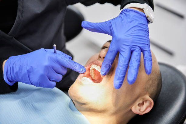 Best Emergency Root Canal Treatment in Rossville, TN